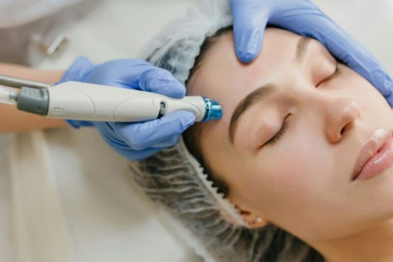 Close-up of a woman receiving a professional skin treatment with a medical-grade facial device at Jolie Beauté clinic